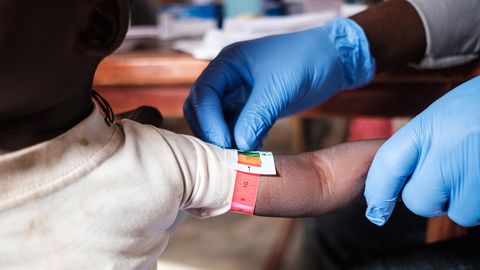 Personal mäter överarmens omkrets med en så kallad MUAC (mid-upper arm circumference) på ett undernärt barn i Zamfara, Nigeria. Foto: Abayomi Akande