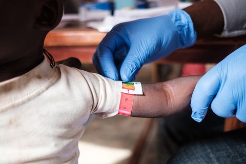 Personal mäter överarmens omkrets med en så kallad MUAC (mid-upper arm circumference) på ett undernärt barn i Zamfara, Nigeria. Foto: Abayomi Akande