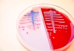 Urinodling där det växer E. coli. Urinprovet som har odlats på plattan kommer från en patient. Foto: Elin Abelson.