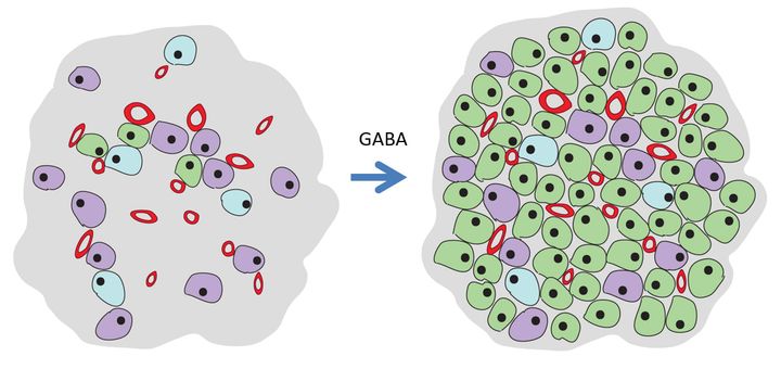 Vid typ 1 diabetes har närmast alla insulinproducerande beta-celler (i grönt) försvunnit i bukspottkörteln. Genom behandling med gammaaminosmörsyra (GABA) är förhoppningen att dessa ska återväxa genom celldelning och omvandling av andra celler.