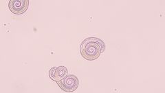 Trikinlarver från det testade vildsvinet i mikroskop. En trikinlarv är cirka 1 mm lång. Bild: Anton De-Jong, SVA.