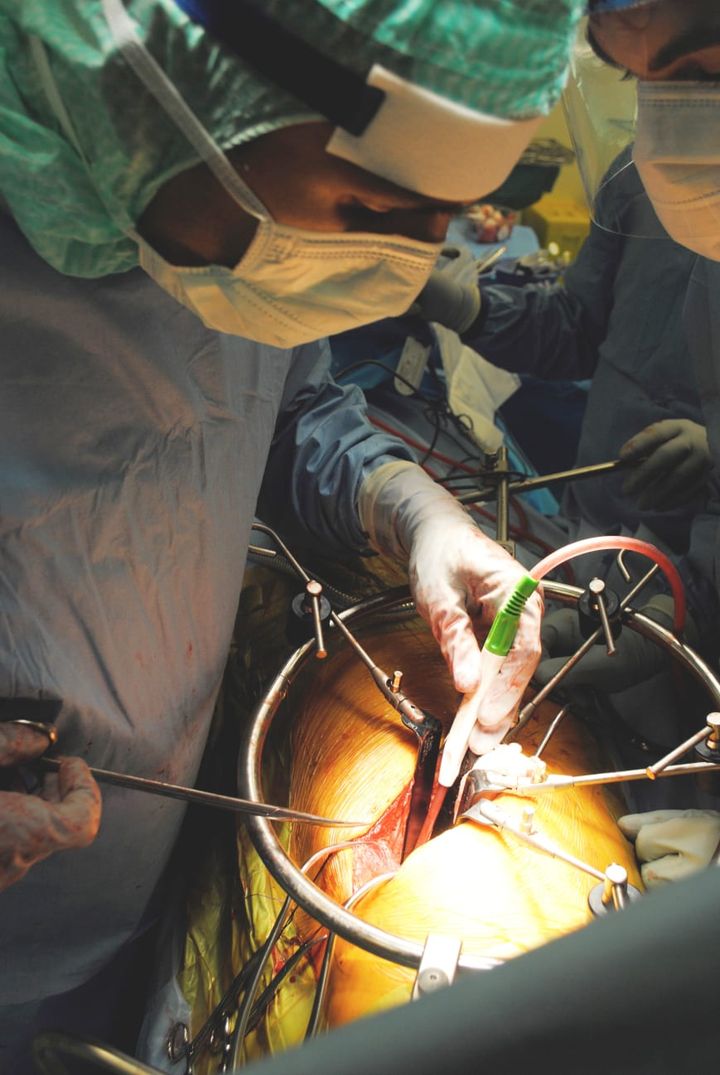 Yohan Robinson, ryggkirurg på Akademiska sjukhuset, opererar en kotpelartumör genom bröstkorgen (Foto: Yohan Robinson)