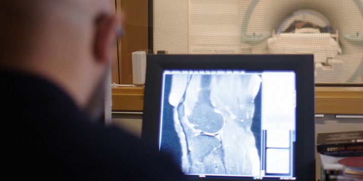 En man tittar på en röntgenbild av en knäled.