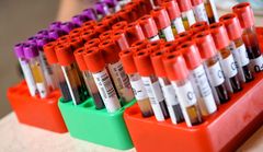 I studien har forskarna undersökt blodprover från närmare 300 barn med leukemi. Blodproverna togs i samband med cancerdiagnostik och har sparats vid Uppsala Biobank.