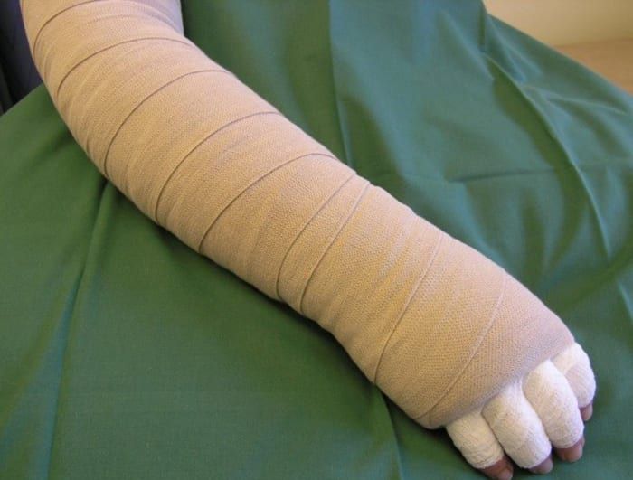 Akademiska sjukhuset tar ett samlat grepp om patienter med lymfödem. I satsningen ingår bland annat screening av riskgrupper, förbättrad patientinformation och inrättande av multidisciplinära team.