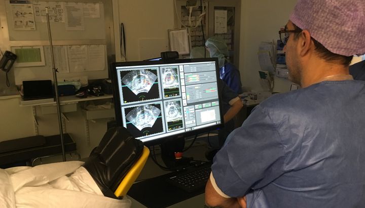 Hittills har nära 130 patienter behandlats med högintensivt fokuserat ultraljud, HIFU, på Akademiska. En utvärdering visar att metoden har små biverkningar beträffande kontinens och potens Jämfört med operation och strålning. På bilden syns Sam Ladjevardi, överläkare i urologi. Foto: Akademiska sjukhuset