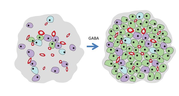 Vid typ 1 diabetes har närmast alla insulinproducerande beta-celler (i grönt) försvunnit i bukspottkörteln. Genom behandling med gammaaminosmörsyra (GABA) är förhoppningen att dessa ska återväxa genom celldelning och omvandling av andra celler.