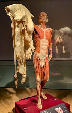 copyright: Institute for Plastination, Heidelberg/Germany