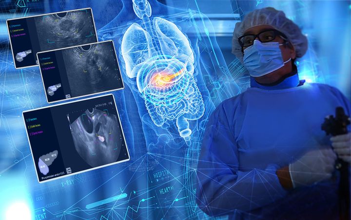 KI-Software MGG_IHU_mAi_Companion