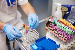 En vårdpersonal hanterar provrör med färgade lock på ett metallbord.