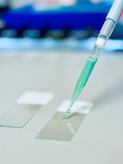 Foto: Elin Abelson, Region Örebro län.