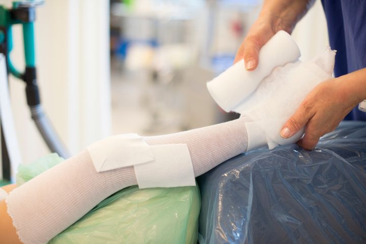 I Norrbotten är det färre personer som bedömer att deras hälsotillstånd är bra, jämfört med på riksnivå.