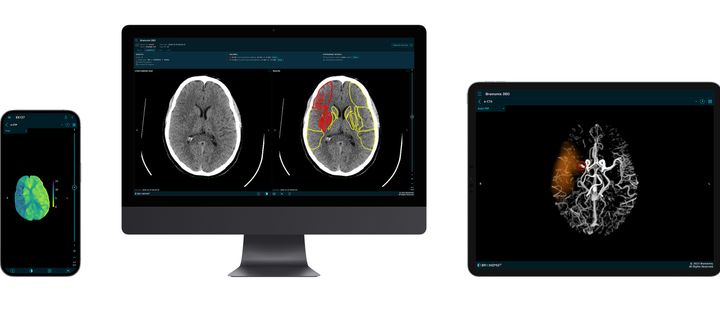 Efter årsskiftet inför Akademiska sjukhuset ett AI-system som automatiskt tolkar strokebilder tagna med datortomografi. Främsta syftet är att förbättra strokevården genom att diagnostiken går fortare och blir mer träffsäker.