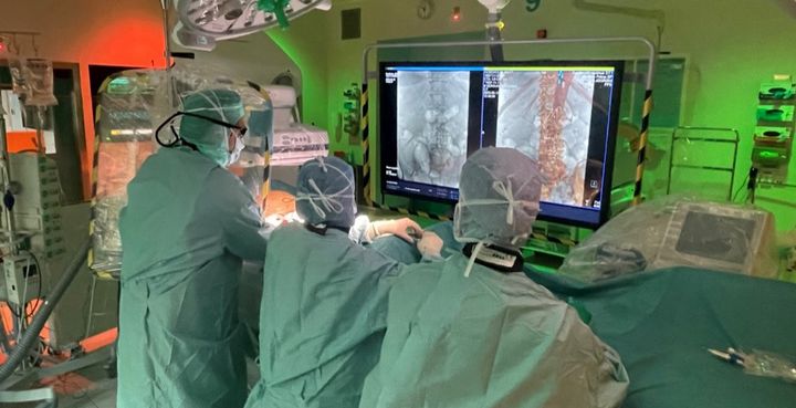 Allt fler patienter med ärftlig sjukdom i stora kroppspulsådern, aorta, kan behandlas minimalinvasivt med endovaskulär kirurgi på Akademiska sjukhuset. Det är operationer som utförs med kateter via ljumsken och är betydligt mer skonsamma för patienten än traditionell öppen kirurgi.