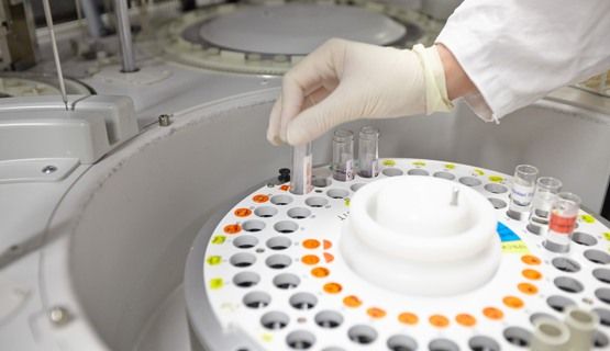 En laboratoriearbetare placerar ett provrör i en centrifug.