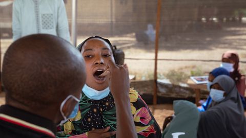 En man använder en träspatel för att undersöka en patient med misstänkt difteri i Nigeria.