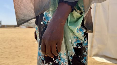 Bild av en kvinnas hand. Hon har en grönmönstrad klänning och i bakgrunden syns ett ökenlandskap. Kvinnan har utsatts för sexuellt våld upprepade gånger i Darfur och sökt vård hos Läkare Utan Gränser i Tawila, Sudan.
