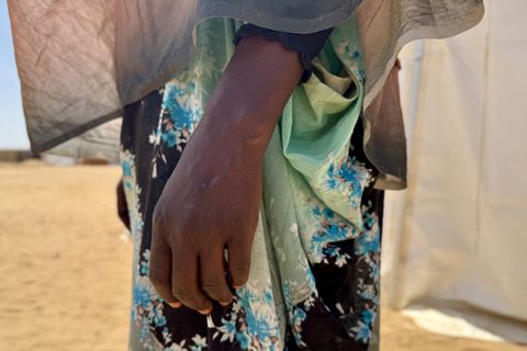 Bild av en kvinnas hand. Hon har en grönmönstrad klänning och i bakgrunden syns ett ökenlandskap. Kvinnan har utsatts för sexuellt våld upprepade gånger i Darfur och sökt vård hos Läkare Utan Gränser i Tawila, Sudan.