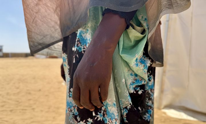 Bild av en kvinnas hand. Hon har en grönmönstrad klänning och i bakgrunden syns ett ökenlandskap. Kvinnan har utsatts för sexuellt våld upprepade gånger i Darfur och sökt vård hos Läkare Utan Gränser i Tawila, Sudan.