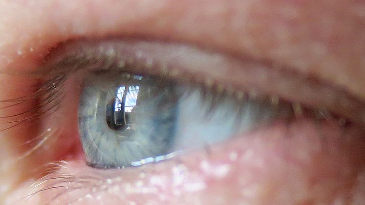Efter implantat behöll chipet sin position i ögat i månader och integrerades snabbt med blodkärlen. Foto: David Callahan