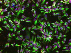 Neural stem cells differentiated with the chip platform.