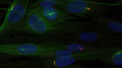 A view of stained CKAP2 cells with cilia labeled in red, and nuclei in green. “It can be seen that ciliary localization of CKAP2 is incredible diverse,” says Jan Hansen, lead author of the study.