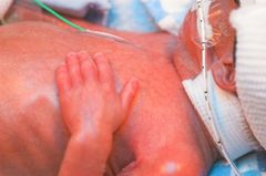 New research reveals details about how cerebral hemorrhages cause brain damage during premature birth. “Instead of remaining flexible and ready to grow into different types of brain cells, the stem cells start changing too early or stop growing altogether,” says Professor Anna Herland.