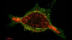 The calcium-regulated protein drug (green) and tumor cell receptors (red) have bonded and internalization is underway, 40 seconds after administration.