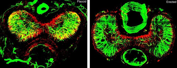 Forskningsrelaterad bild 1 Tvärsnittsbilder av en icke-erigerad (vänster) och erigerad (höger) muspenis med fibroblaster i rött. De centrala gröna fibrerna representerar de glatta muskelcellerna i penisens erektila vävnad (corpora cavernosa).