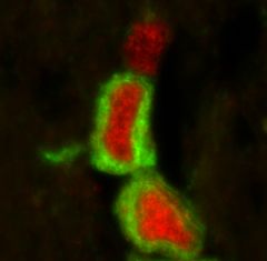 Oligodendrocytes Photo of Photo of oligodendrocytes in a tissue sample from the human brain.  Credit: Jonas Frisén, Cell Novenber 6th, 2014.