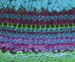 Image of an inner ear from the study