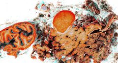 Scan of duodenum and pancreas.