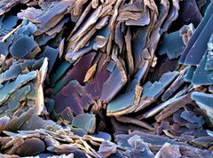 Electron micrograph of a human gallstone.