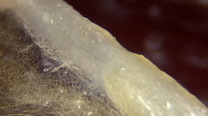 Magnified view of living fascia recorded during endoscopic surgery by French surgeon Jean-Claude Guimberteau.