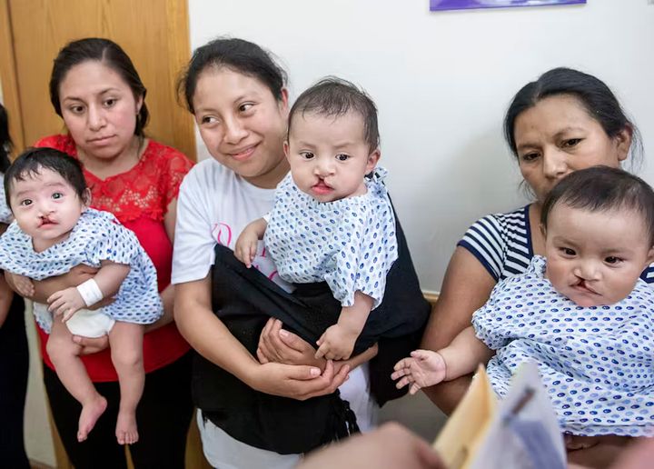 Några av Operation Smiles små patienter som fått en operation för sin läpp-käk-gomspalt under tidigare uppdrag i Puebla, Mexiko. Foto: Jasmin Shah