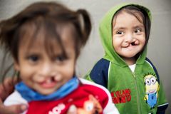 Några av Operation Smiles små patienter som fått en operation för sin läpp-käk-gomspalt under tidigare uppdrag i Puebla, Mexiko. Foto: Jasmin Shah