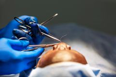 Patient ligger på operationsbordet. Handsbeklädda händer (blå) syr vid patientens mun. Närbild, utan att man ser detaljer.