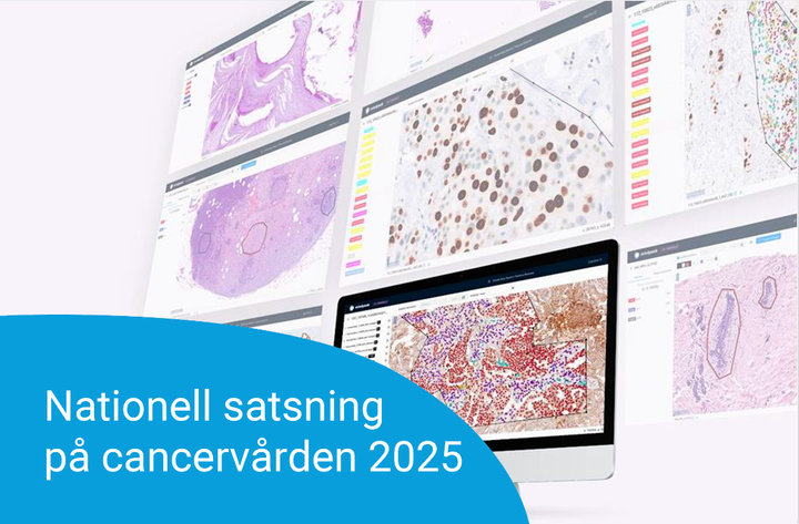 Bilder på olika vävnader