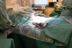 Medicinsk utrustning och operationsduk på en sjukhussäng i ett operationsrum.