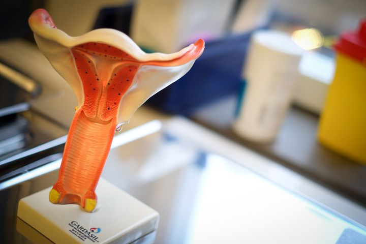 Bilden föreställer en modell av en livmoder