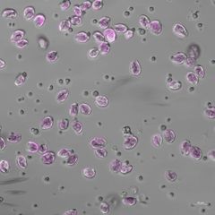 En bild från ett mikroskop med runda, lila figurer och mindre grå.
