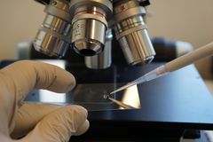 En person i labbhandskar håller ett objektglas under ett mikroskop och applicerar en liten mängd vätska med en pipett.