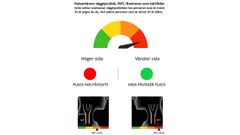 Väggtjocklek och förekomst av plack i halsartärerna är basen för att bedöma graden av åderförkalkning. I projektet jämfördes väggtjockleken hos deltagarnas med personer av samma ålder och kön och rapporterades grafiskt som ”kärlåder”, grönt om lägre kärlålder eller rött om högre än den kronologiska åldern. Plack visades som ett ”trafikljus”, grönt om plack inte påvisats och rött om plack påvisats.
