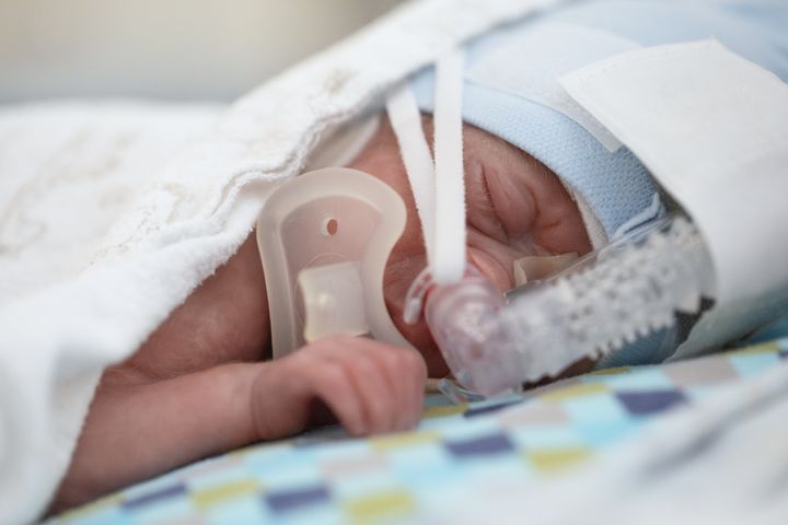 Barn som andas med hjälp av CPAP.