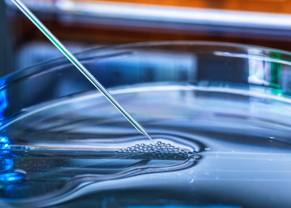 Window Cell Small Capsule technology opens new window into individual cells | Umeå University